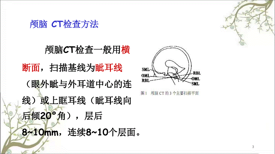 颅脑断面解剖课件_第3页