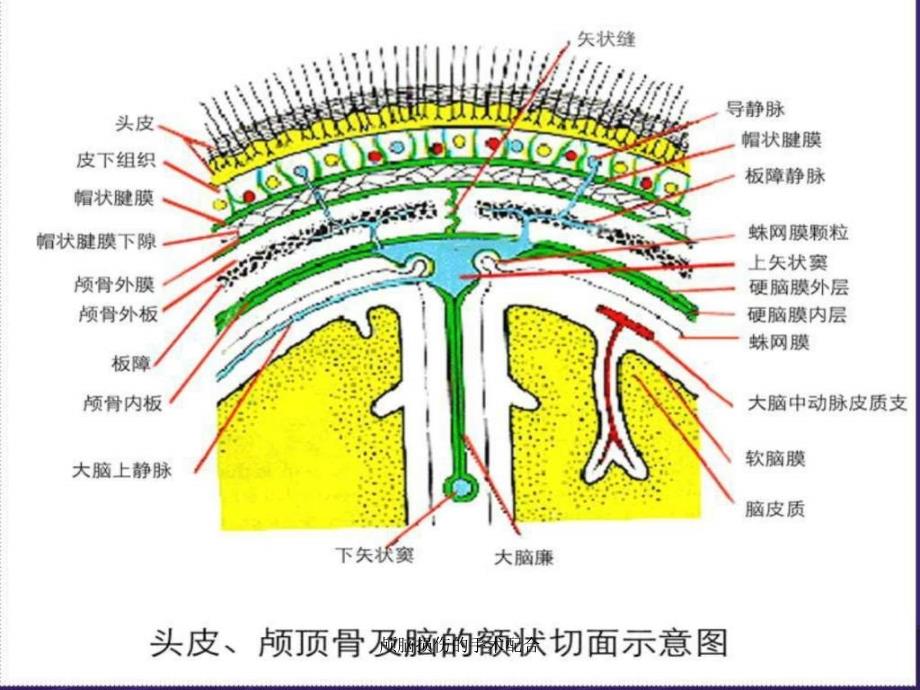 颅脑损伤的手术配合课件_第3页