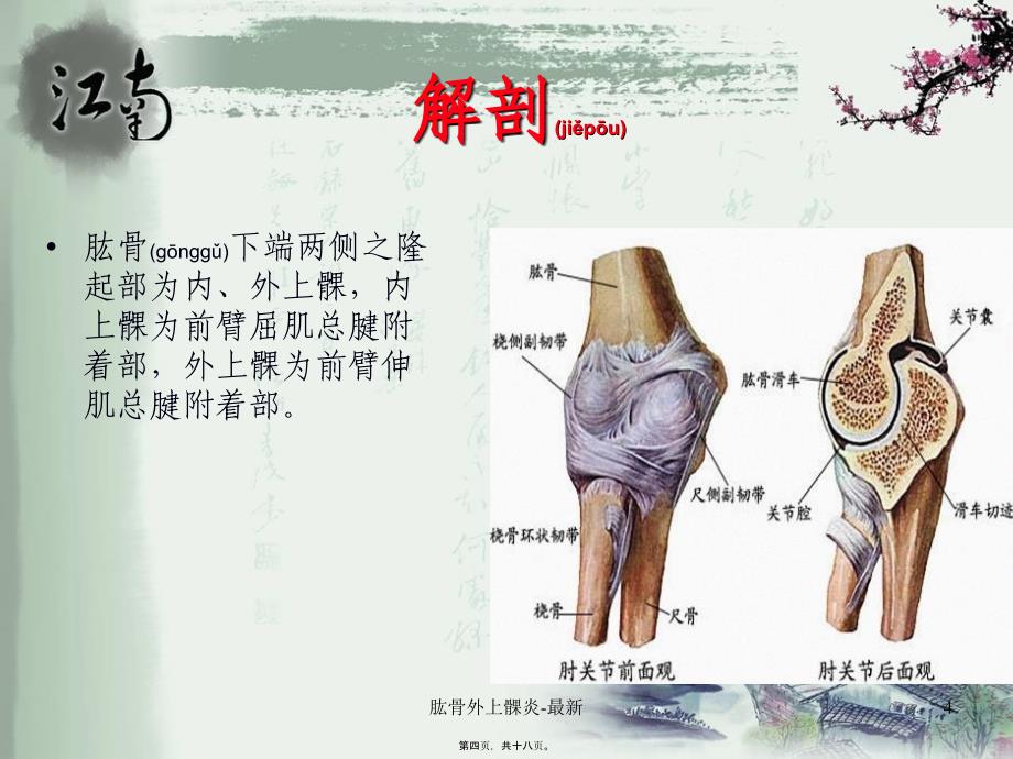 肱骨外上髁炎-最新课件_第4页