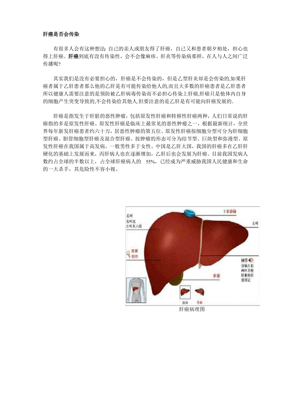 肝癌传染吗_第1页