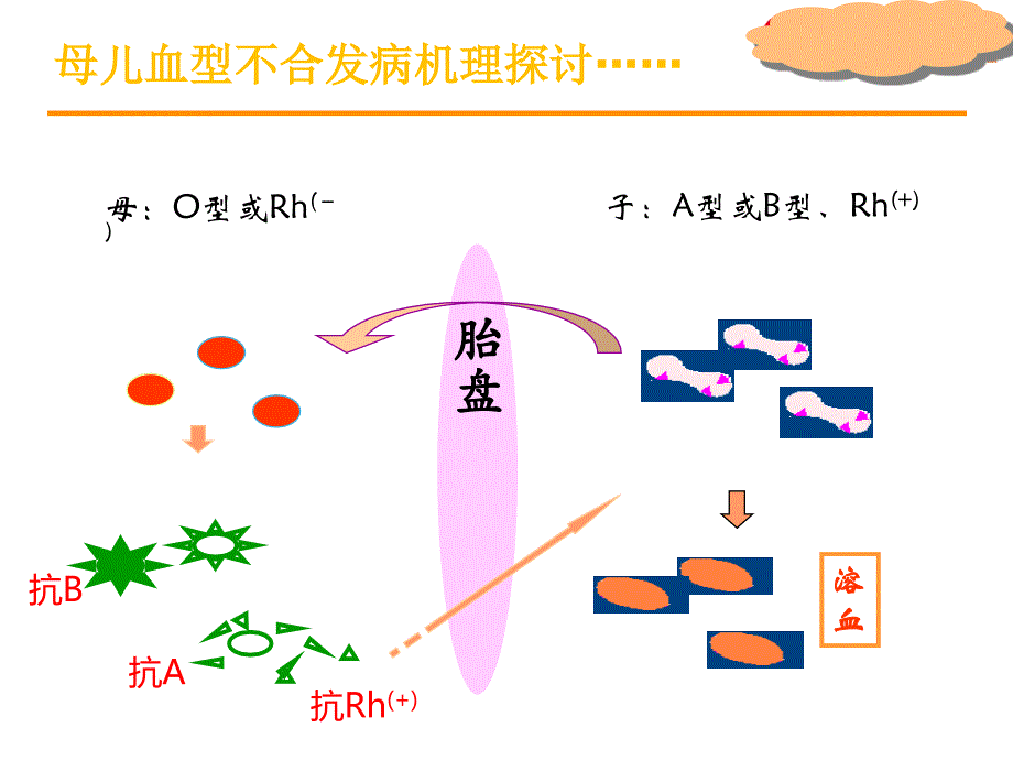 母儿血型不合_第3页