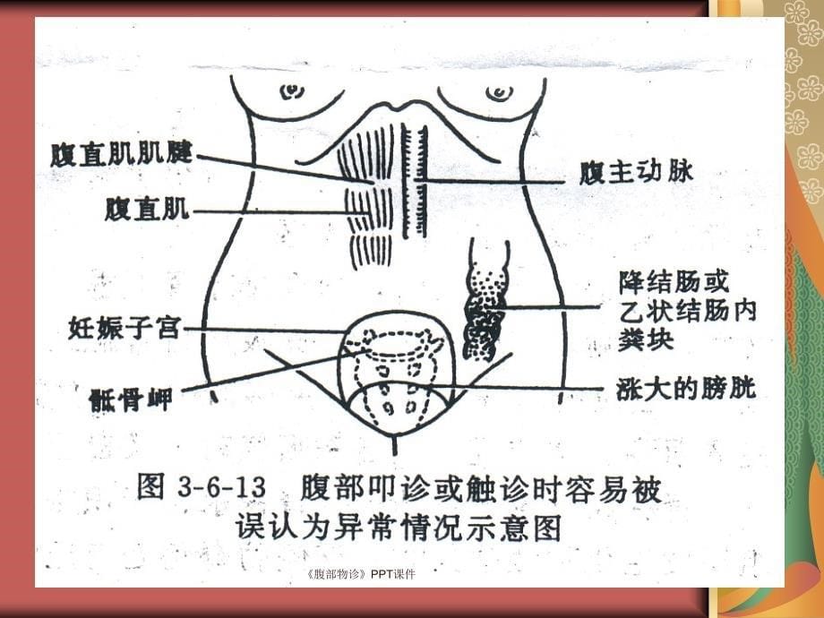 腹部物诊课件_第5页