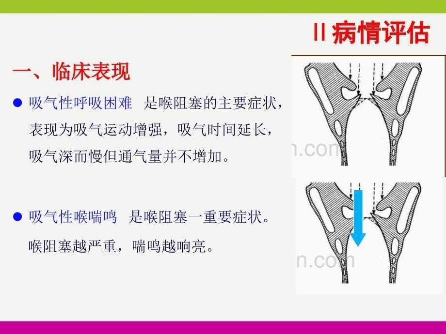 喉阻塞患者的护理及健康指导ppt_第5页