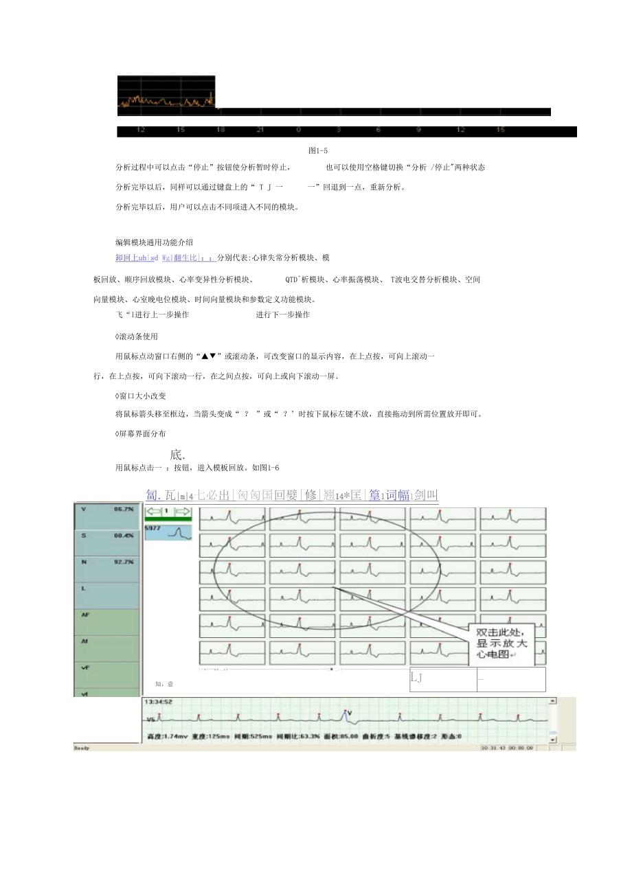 (整理)动态心电图分析软件使用说明书_第3页