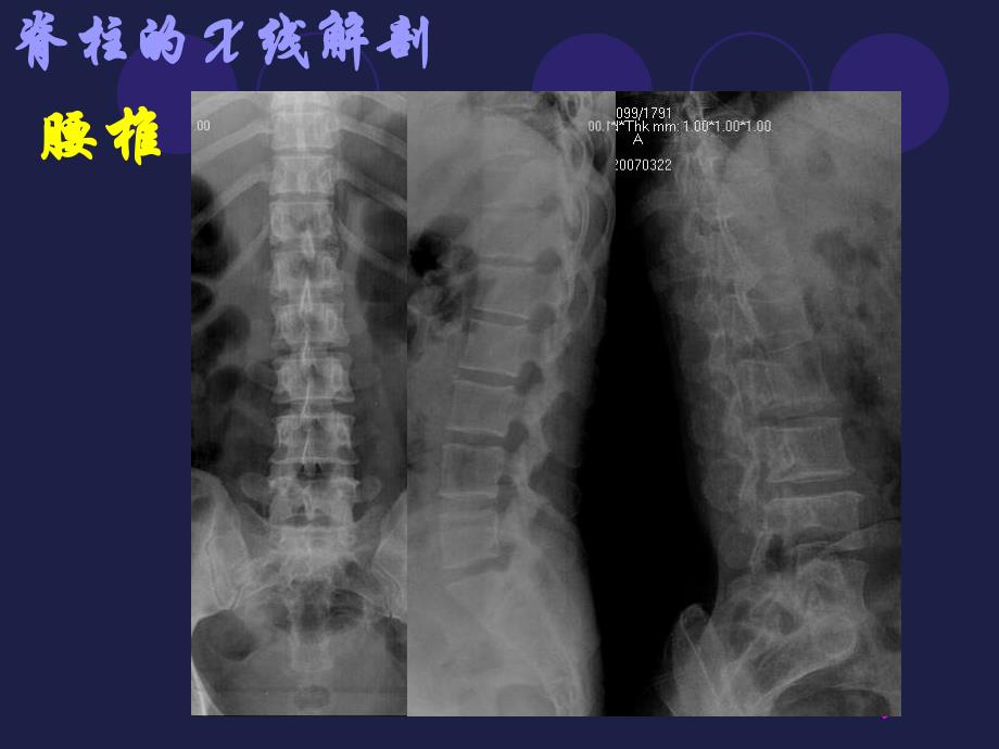 腰椎影像解剖学_第1页