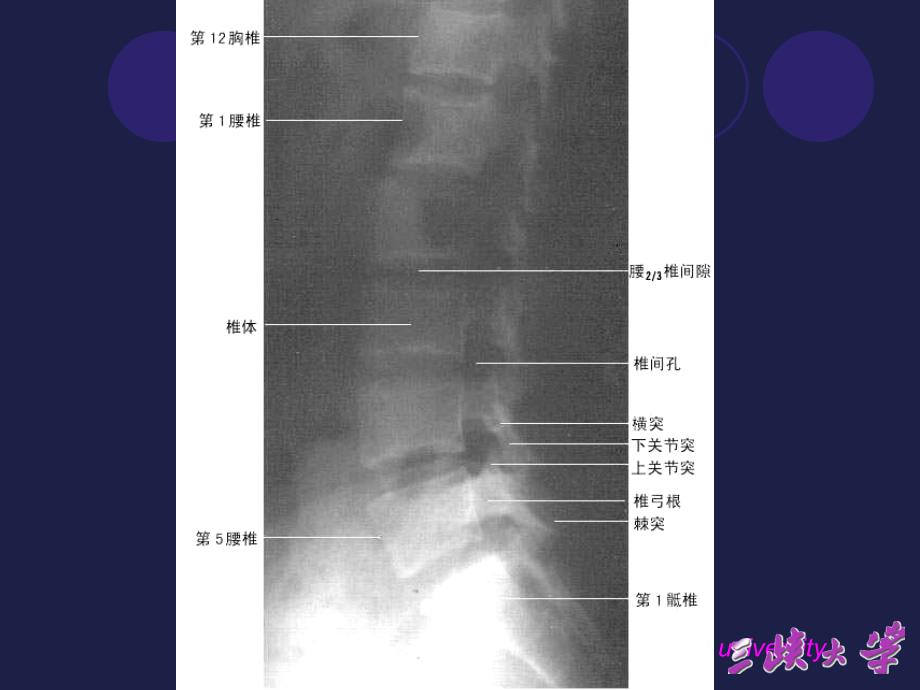 腰椎影像解剖学_第2页