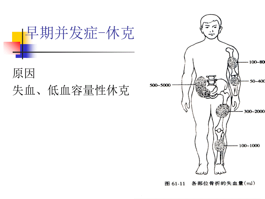 骨折并发症的护理PPT课件_第2页