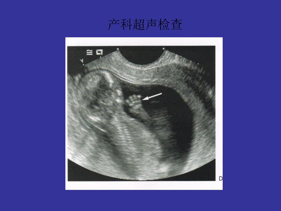 产科的超声检查_第1页