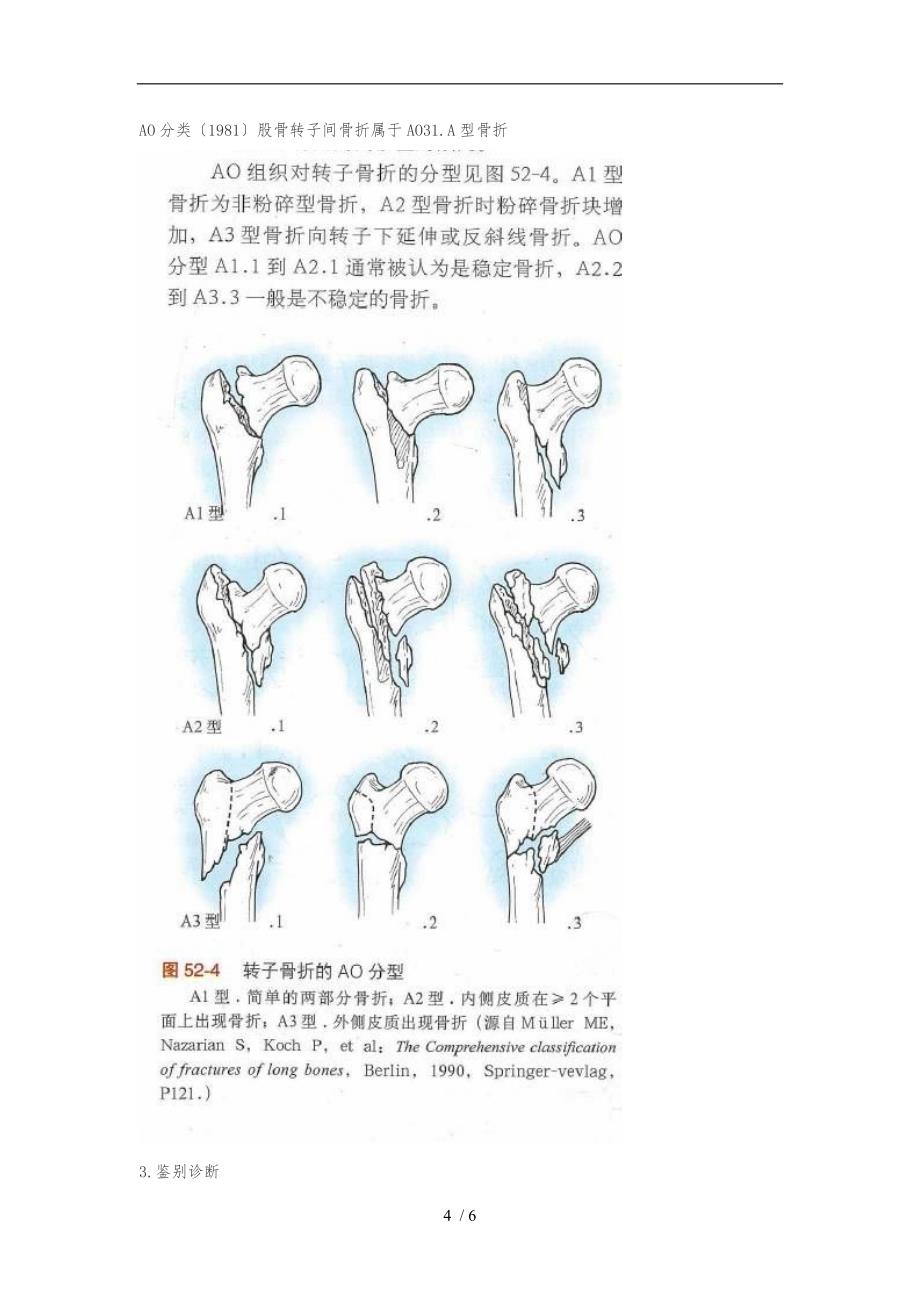 股骨转子间骨折诊疗常规_第4页