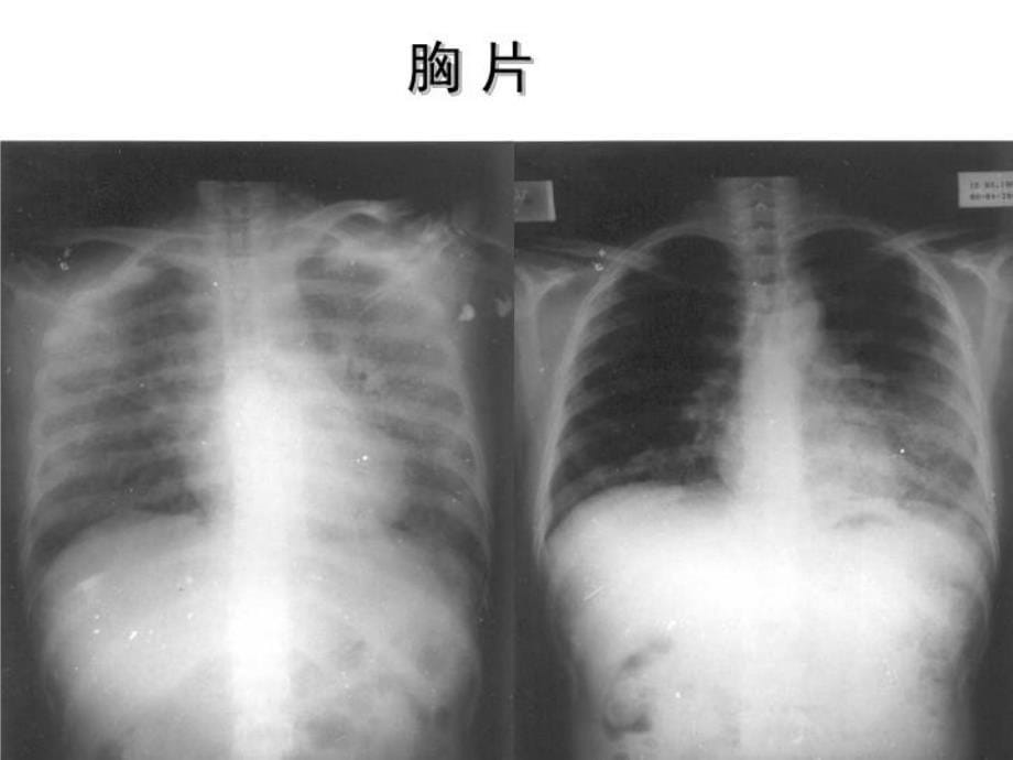 最新协和医院机械通气临床应用精品课件_第5页