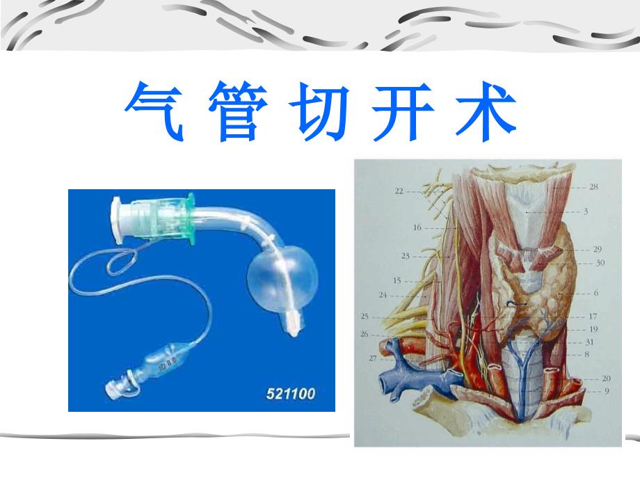 气管切开术.ppt课件_第1页