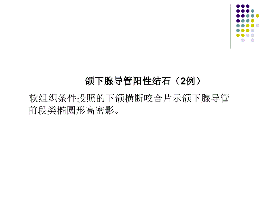 口腔影像学：涎腺疾病影像学诊断_第3页