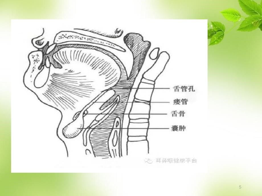 护理查房甲状舌管囊肿PPT参考幻灯片_第5页