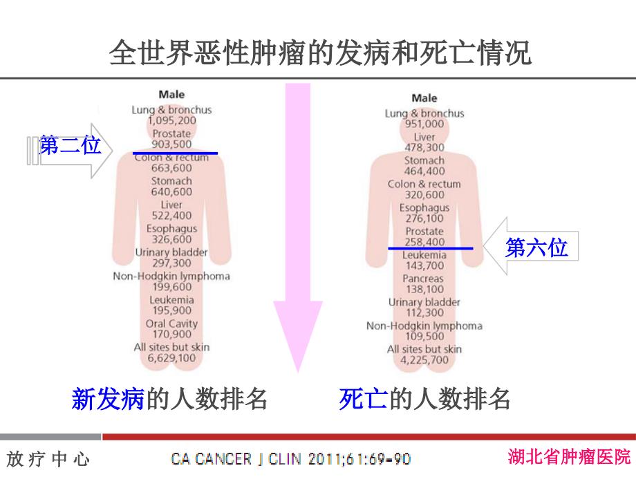 前列腺癌的放射治疗_第4页