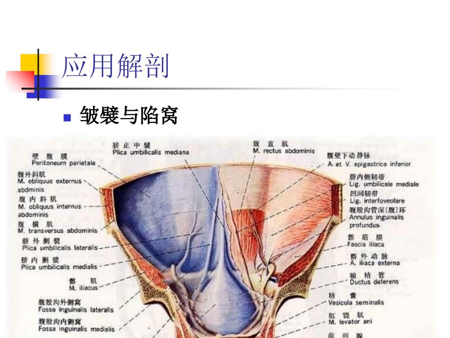 腹腔镜疝修补术详解_第2页