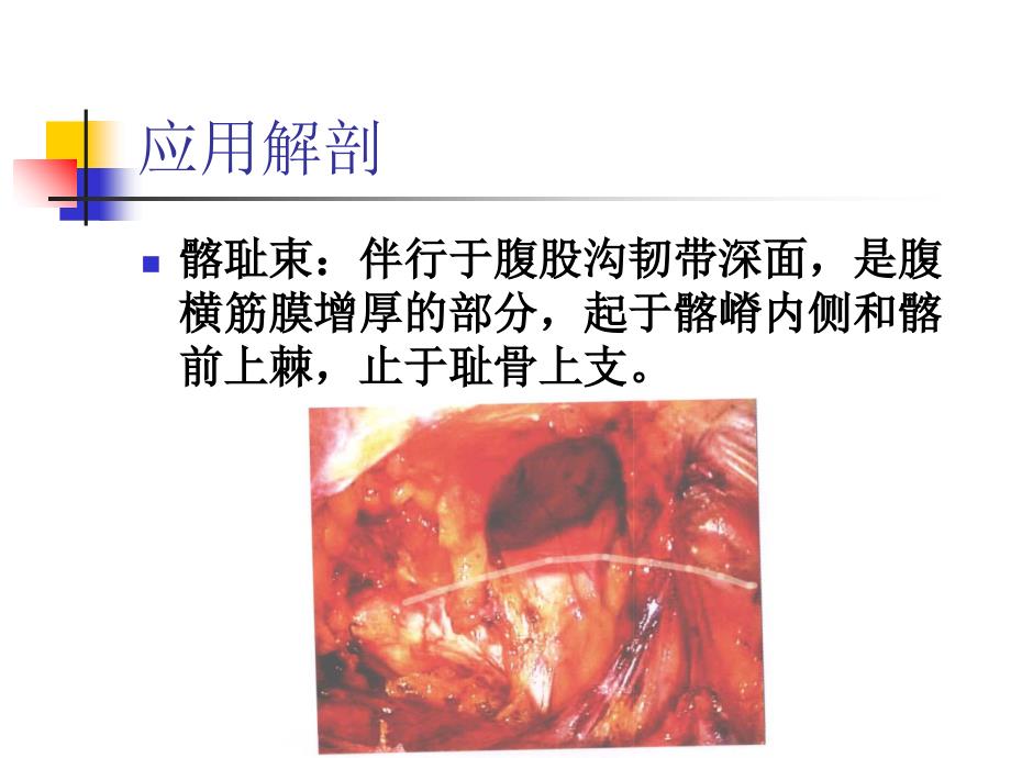 腹腔镜疝修补术详解_第4页