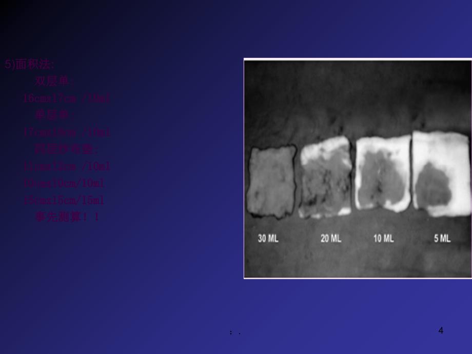 产后出血的评估方法汇总ppt课件_第4页