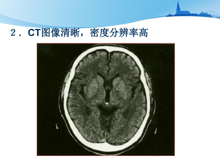 第五章-CT设备_第4页