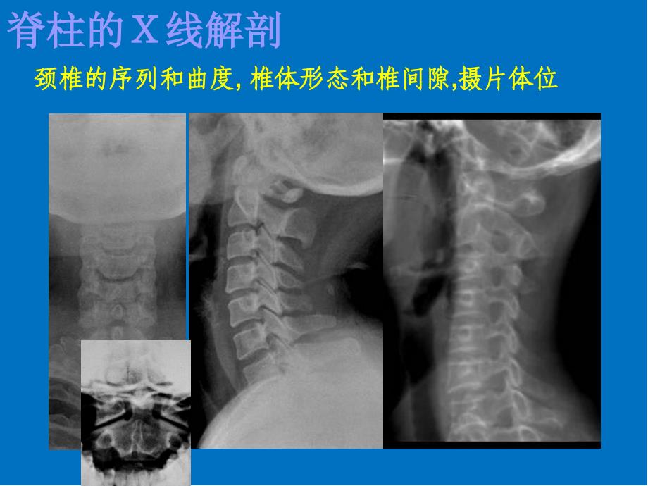 颈椎影像解剖学医学PPT课件_第4页