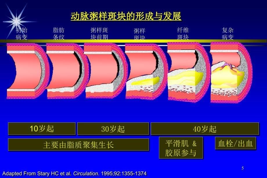 医学专题：心绞痛-合理用药_第5页