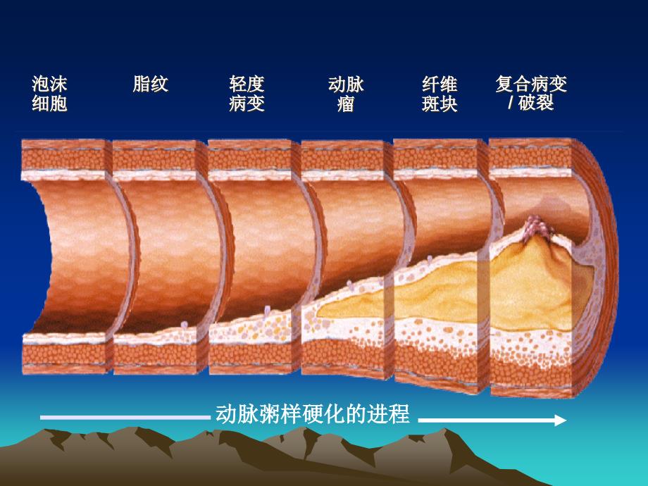 冠心病诊断与治疗指南课件_第3页