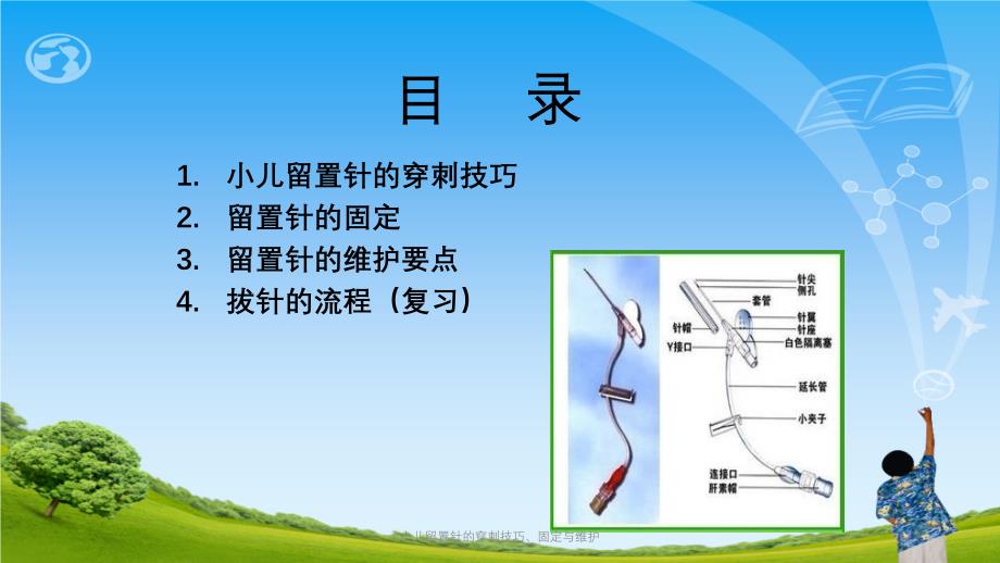 小儿留置针的穿刺技巧固定与维护ppt课件_第2页