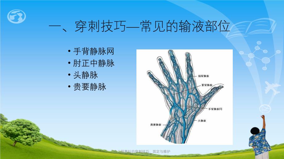 小儿留置针的穿刺技巧固定与维护ppt课件_第4页