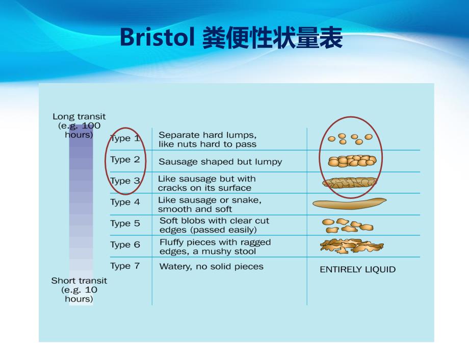 慢性便秘诊断及治疗_第3页