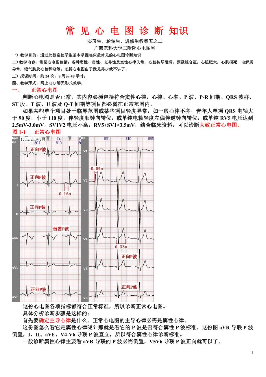 另类心电图讲义-1---正常心电图、心律失常诊断有关概念-2.doc_第1页