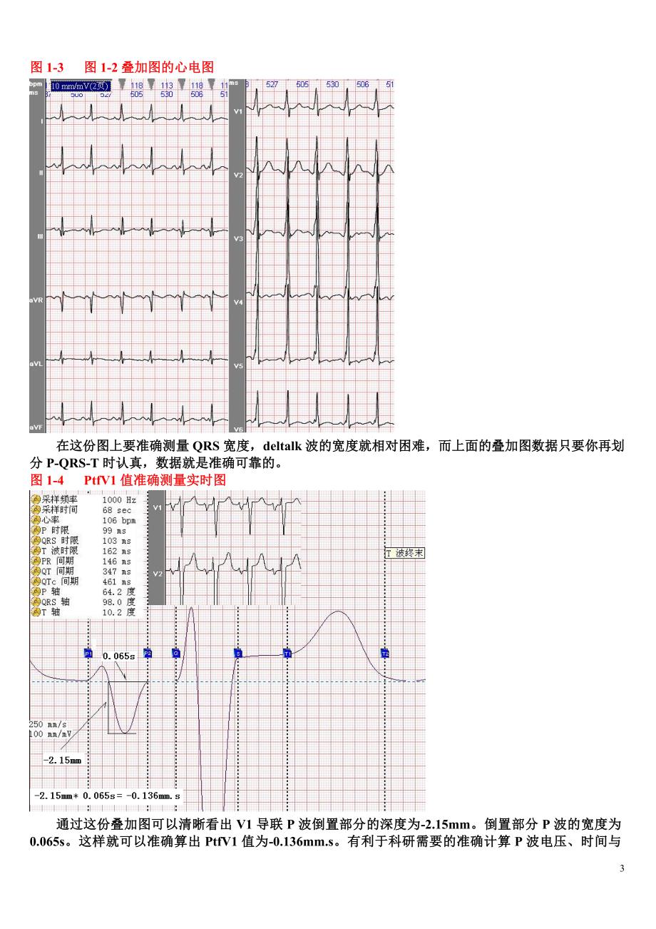 另类心电图讲义-1---正常心电图、心律失常诊断有关概念-2.doc_第3页