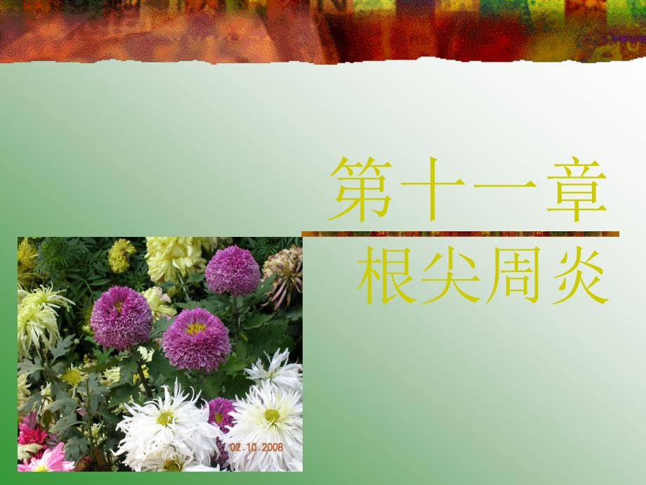 第十一章 根尖病_第1页