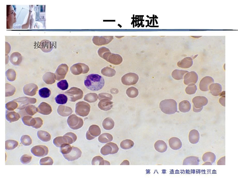 造血功能障碍性贫血_第5页