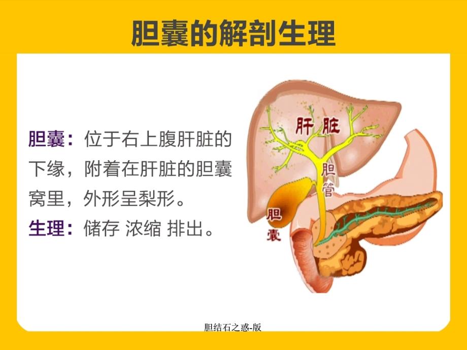 胆结石之惑版课件_第2页