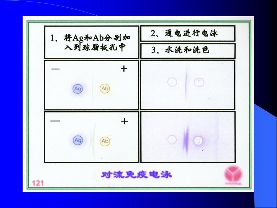 《免疫电泳技术》PPT课件.ppt_第4页