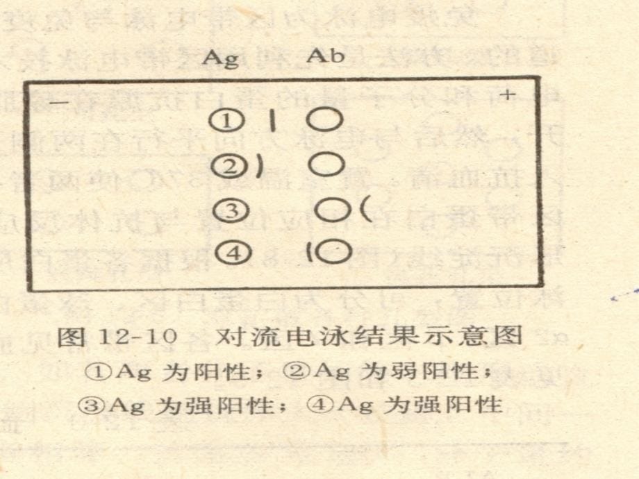 《免疫电泳技术》PPT课件.ppt_第5页