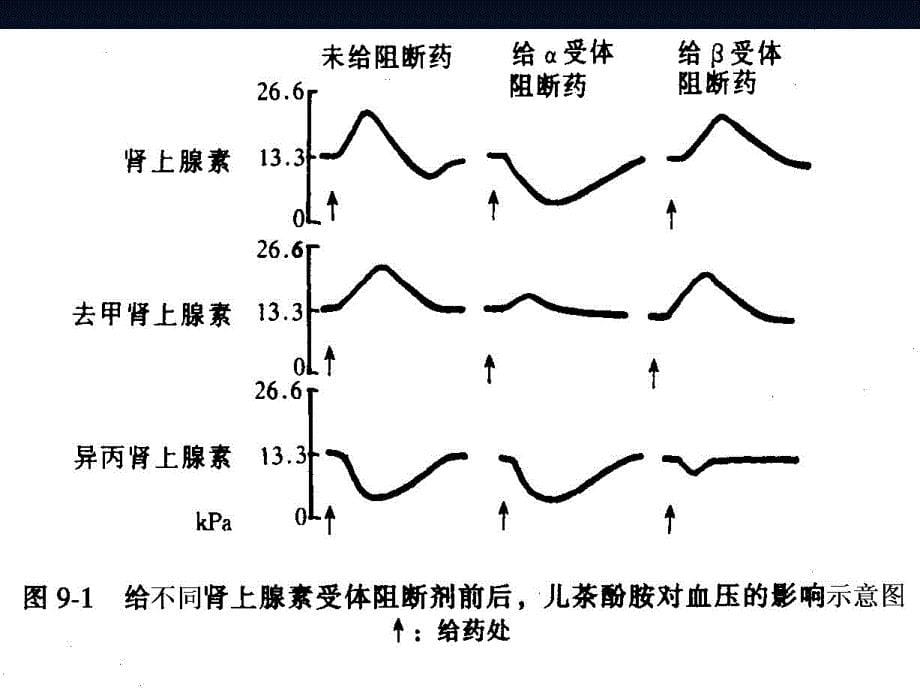 肾上腺素受体阻断药_第5页