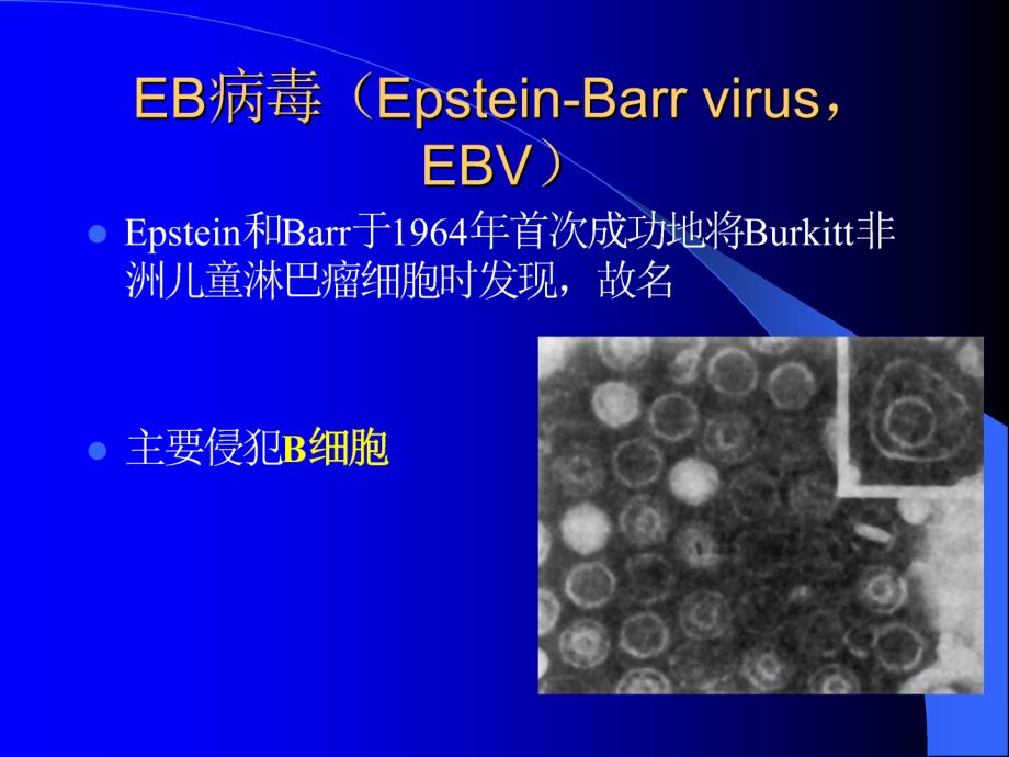 医学专题：传染性单核细胞增多症_第4页