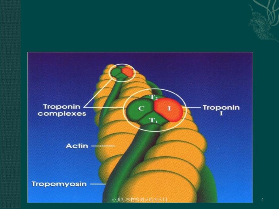 心脏标志物检测及临床应用课件_第4页