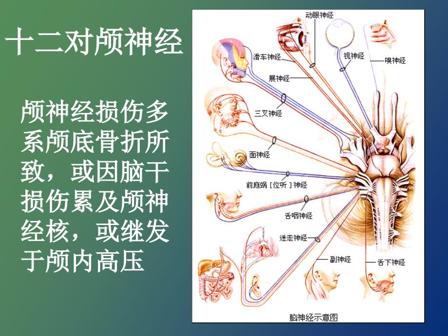 颅脑损伤合并颅神经损伤的临床表现_第2页