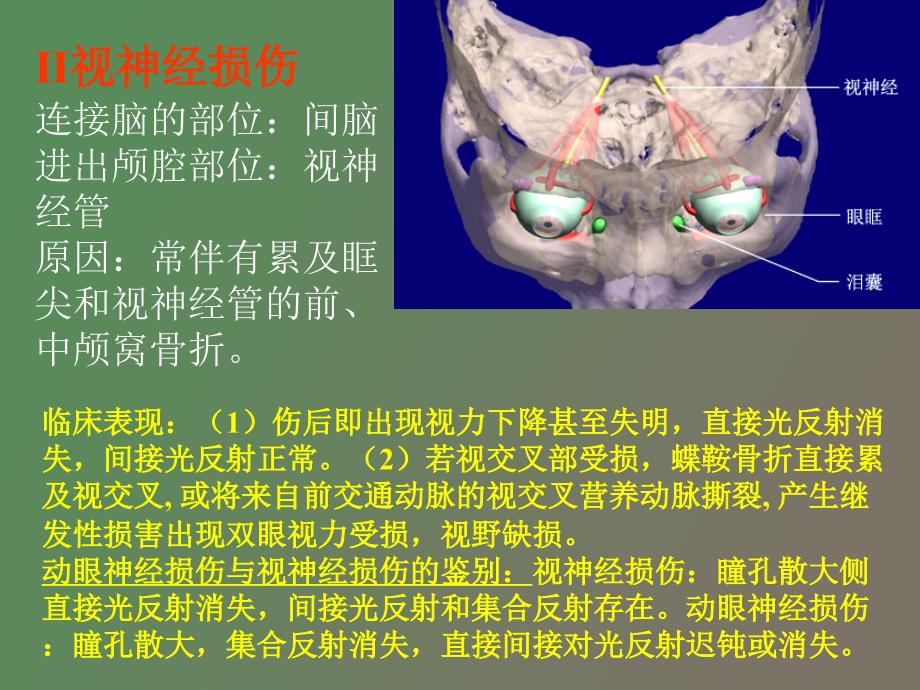 颅脑损伤合并颅神经损伤的临床表现_第4页