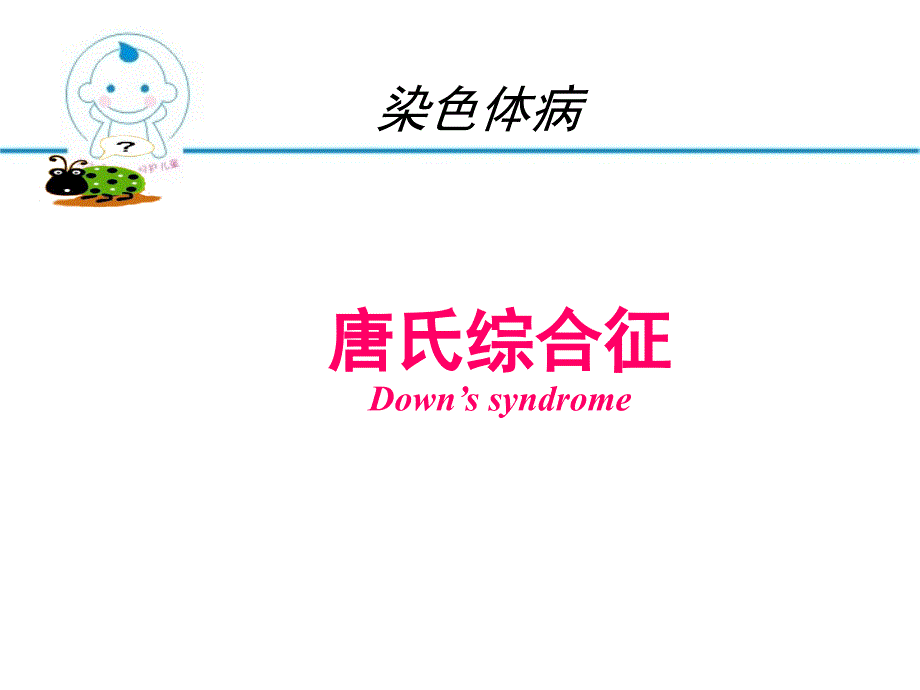 唐氏综合征.ppt_第4页