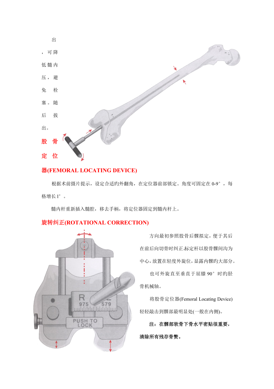 人工膝关节置换术标准手册强生公司_第4页