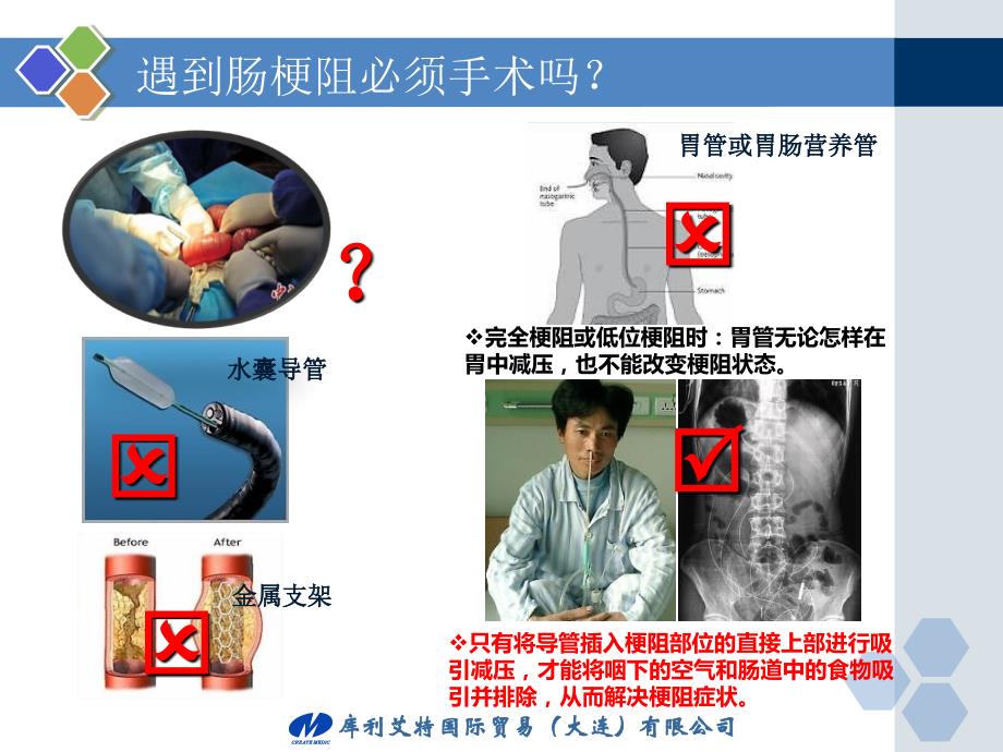 临床科室肠梗阻导管使用护理讲座培训深圳课件_第4页