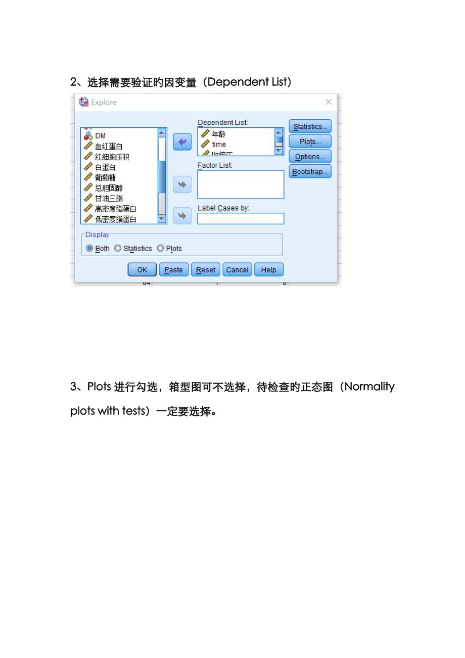 如何检验数据是否属于正态分布_第4页