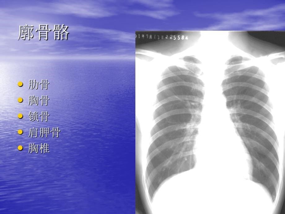 教你如何看肺部CT_第5页