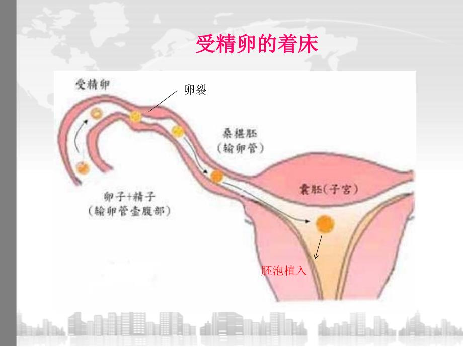 异位妊娠教学查房课件_第4页