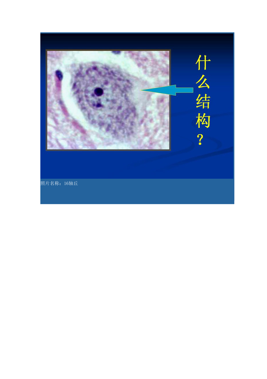 组织学与胚胎学实验考试图及答案!.doc_第3页