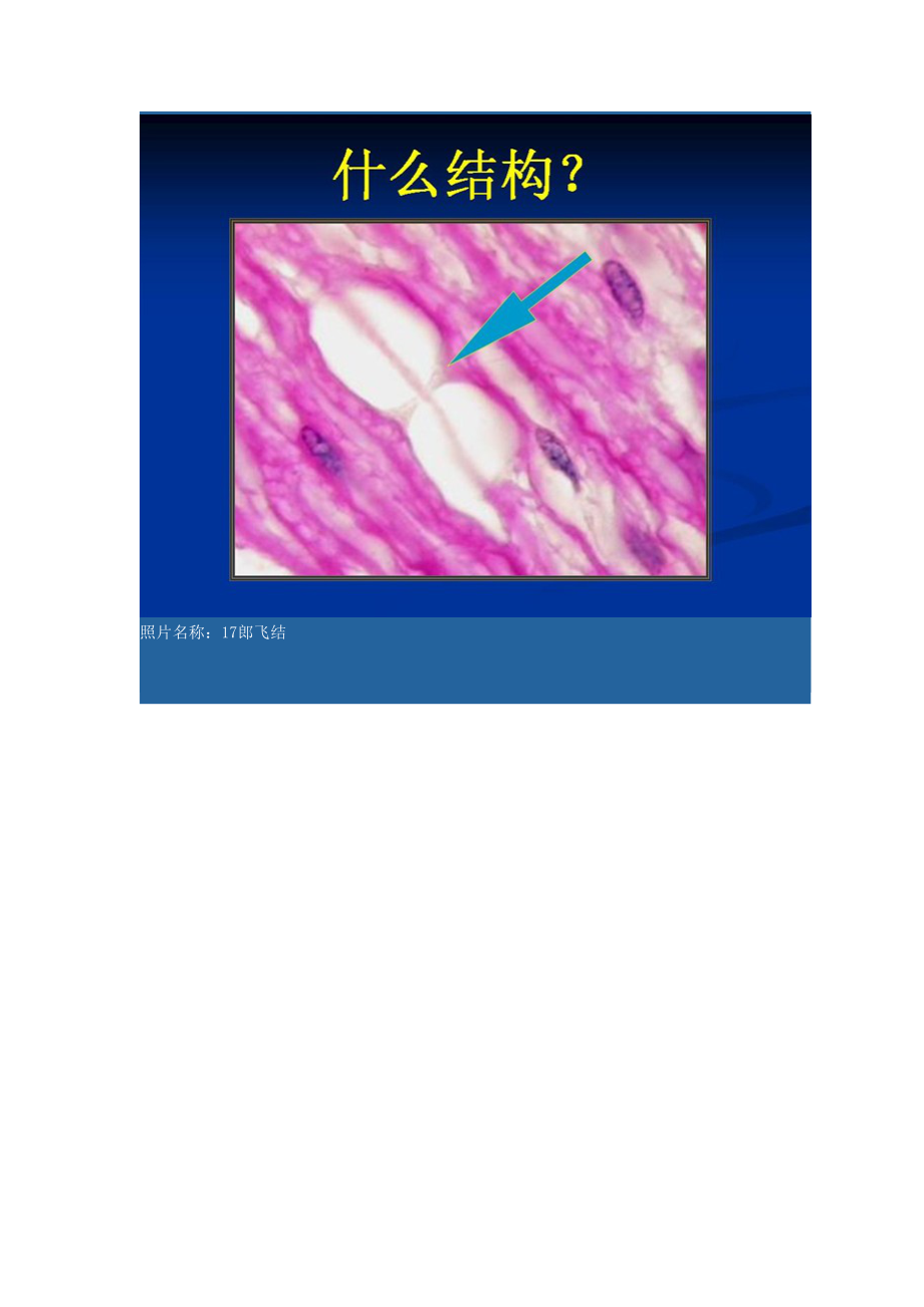 组织学与胚胎学实验考试图及答案!.doc_第4页