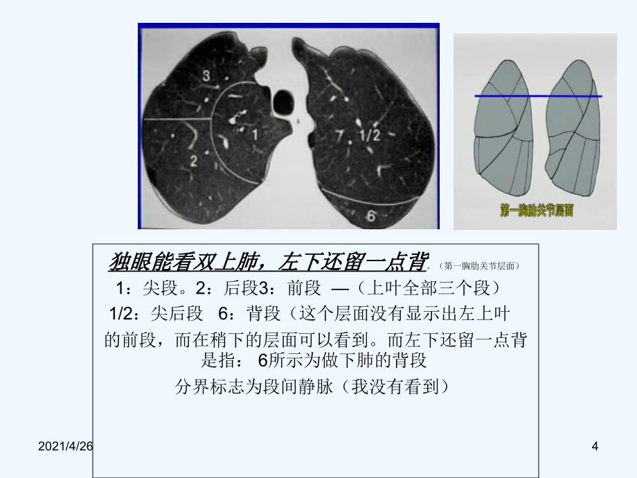 肺段CT识别口诀配图_第4页