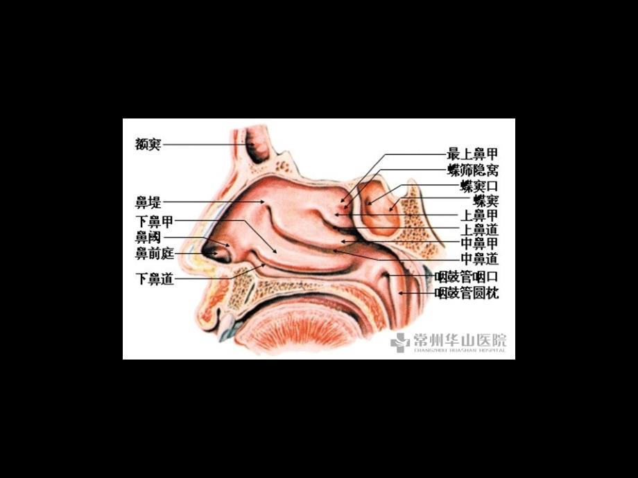 鼻息肉护理PPT课件_第2页